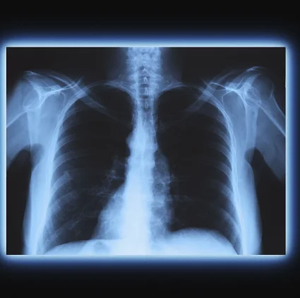 X Ray